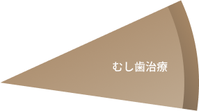 むし歯治療