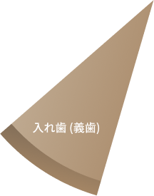 入れ歯 (義歯)